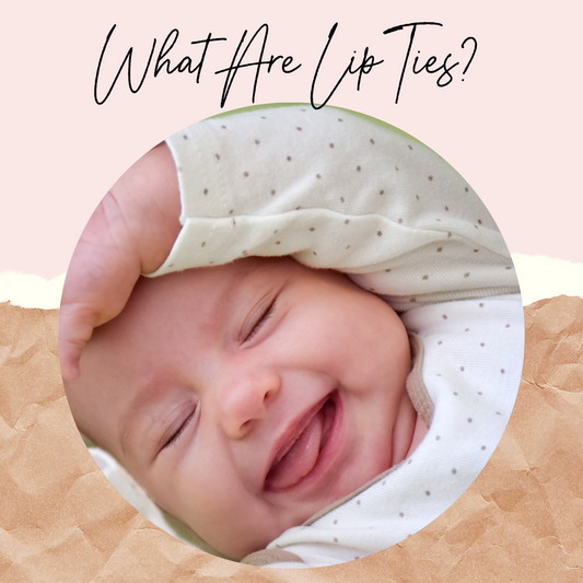 What Are Lip Ties and How Do They Impact Breastfeeding