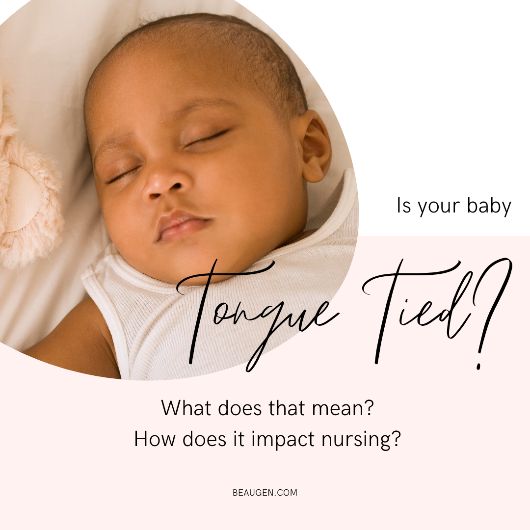 Is Your Baby Tongue Tied?